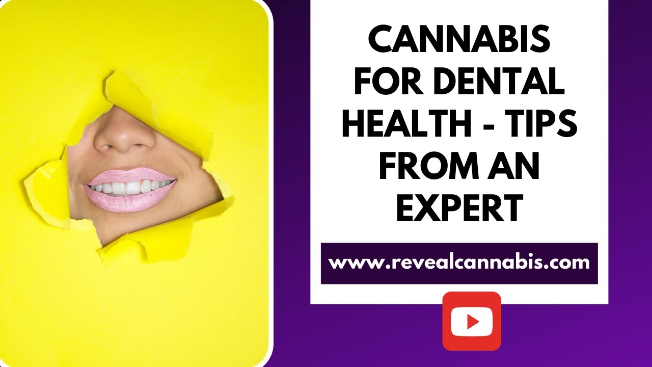 Cannabis and CBD For Dental Health - Tips from an Expert