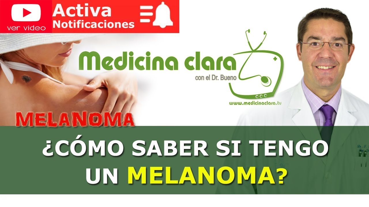 Melanoma,  IMPORTANTE: cómo saber si tengo un melanoma | Medicina Clara