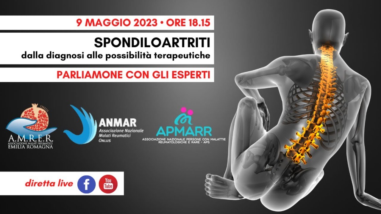 SPONDILOARTRITI:  dalla diagnosi alle possibilità terapeutiche