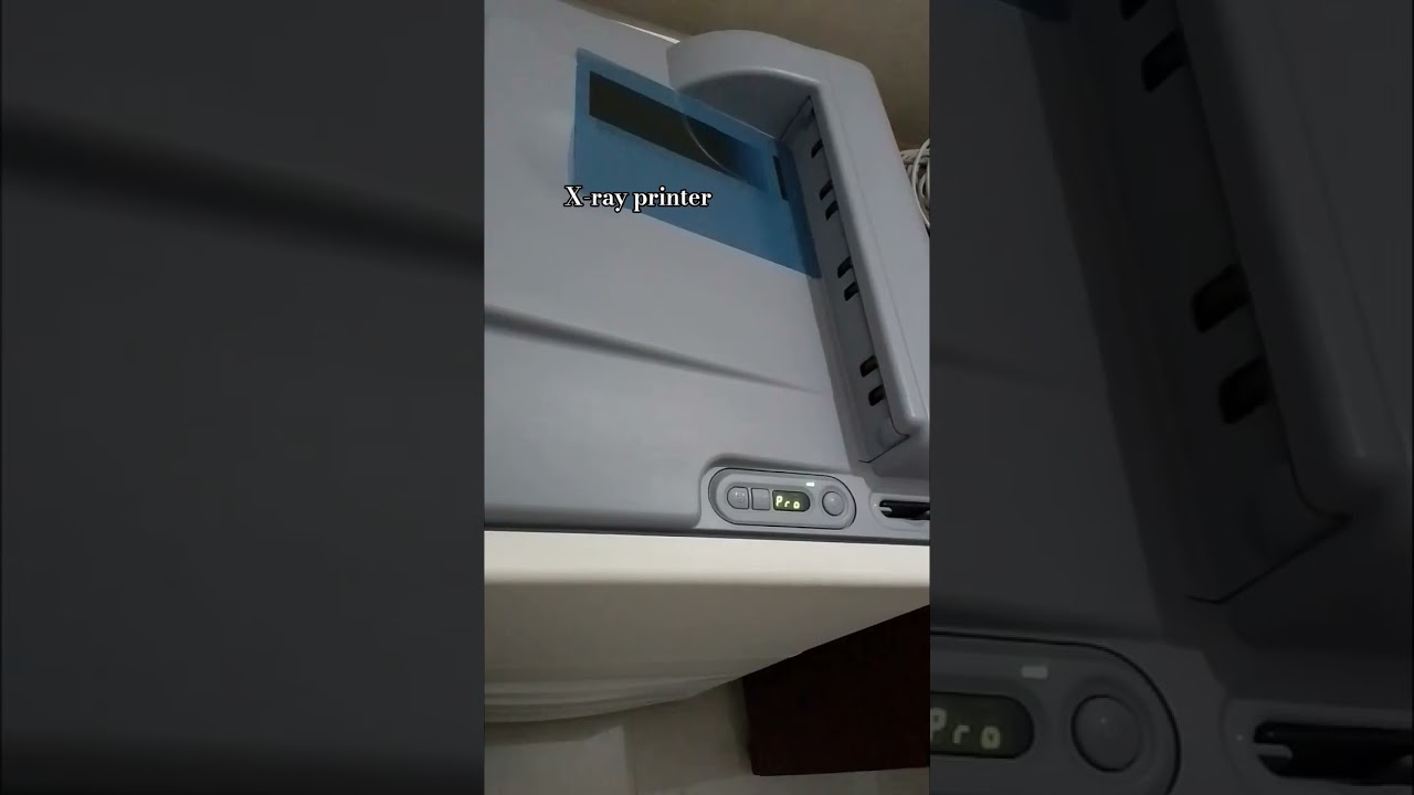 x-ray printer #shortfeed #xray #science#radio #fujifilm#diagnostic