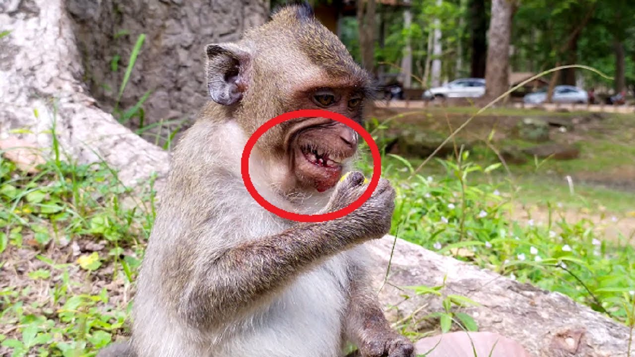 Deep Pitiful Orphan Jessie fall BREAK on Her chin and Teeth, Very Breaking-heart!