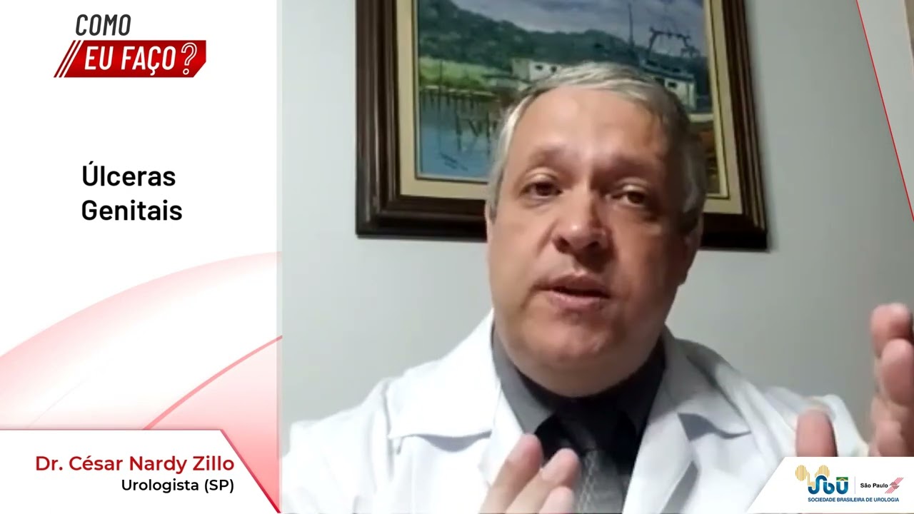 Como eu fa&ccedil;o: &Uacute;lceras genitais