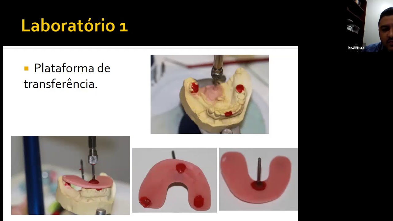 Passo a passo PPR