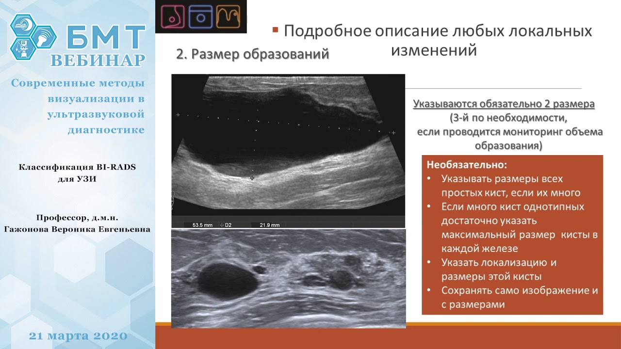 Классификация BI-RADS для УЗИ
