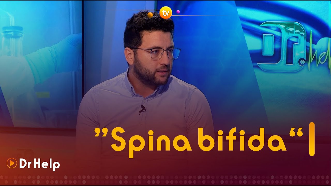 كل ما يجب معرفتُه عن مرض السنسنة المشقوقة أو 