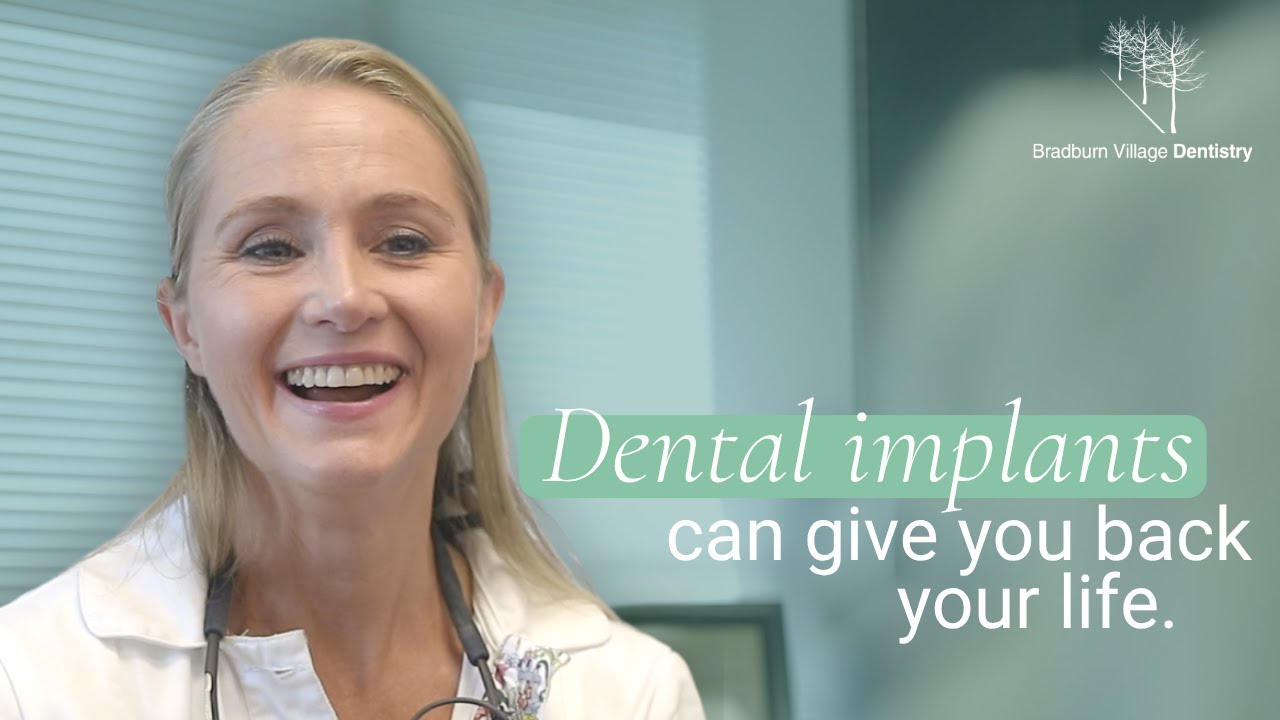 The Life-Changing Benefits of Dental Implants