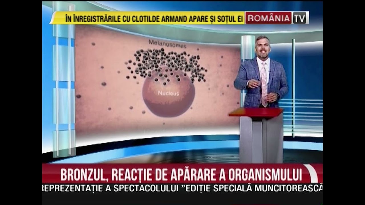 DOCTOR MIT, cu Dr. Bogdan Ivanescu, 06.08.2021. Bronzul, reactie de aparare a organismului