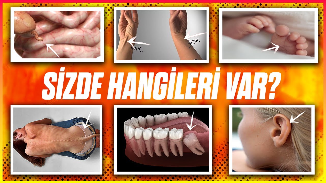 Bu Körelmiş Organların Kaç Tanesi Sizde Var?