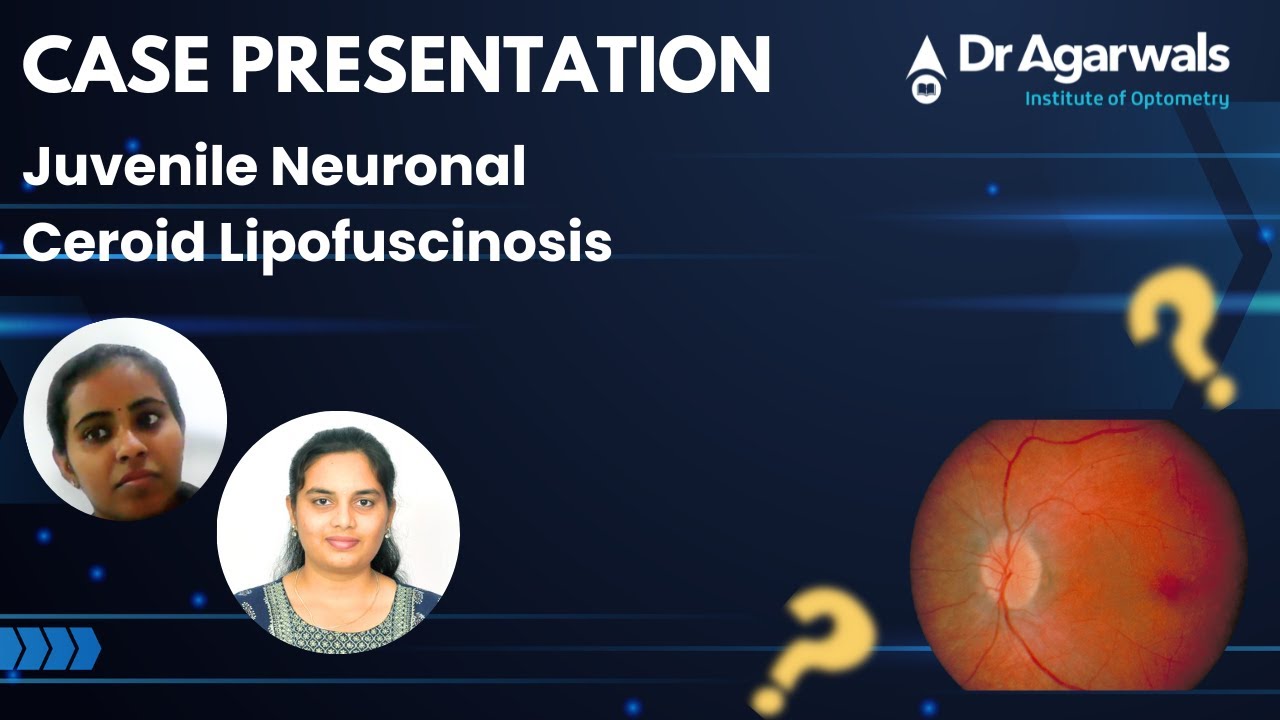 Case Presentation: Juvenile Neuronal Ceroid Lipofuscinosis