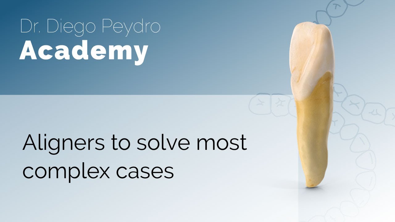 How I Use aligners to solve the most complex cases