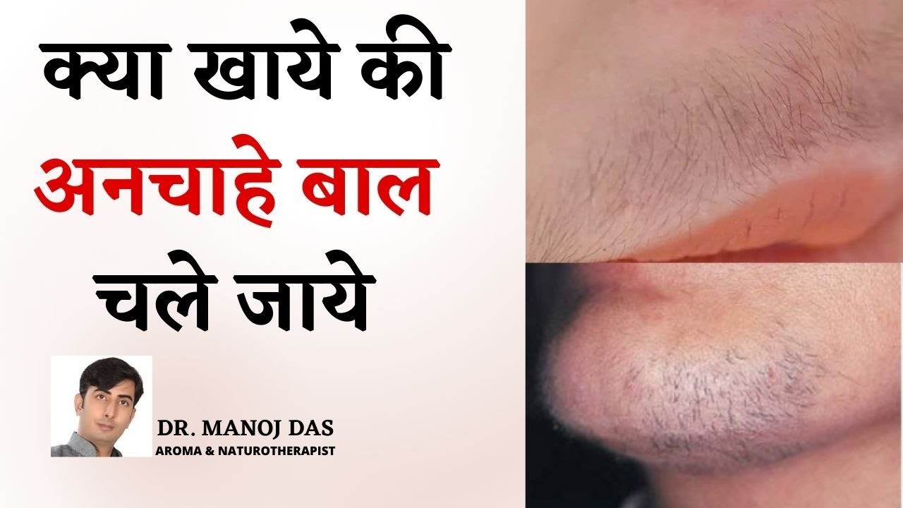 अनचाहे बालों के लिए अपनी डाइट में क्या खायें।  HOW TO GET RID OF UNWANTED HAIR I DR. MANOJ DAS