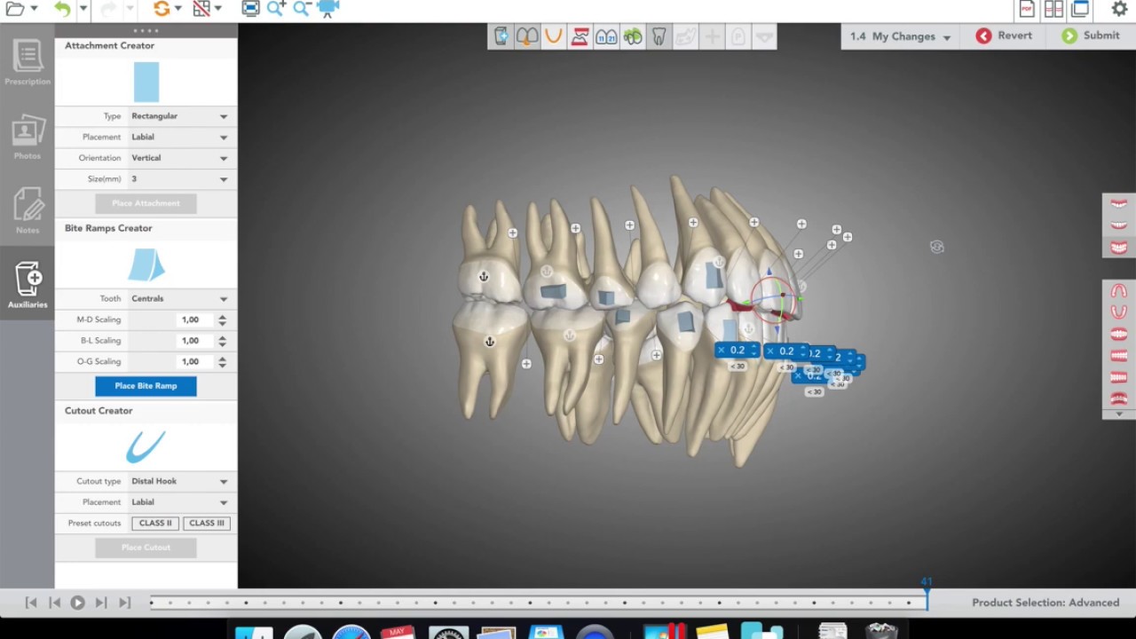 Learn How to  Perform the perfect treatment plan with Spark Aligners