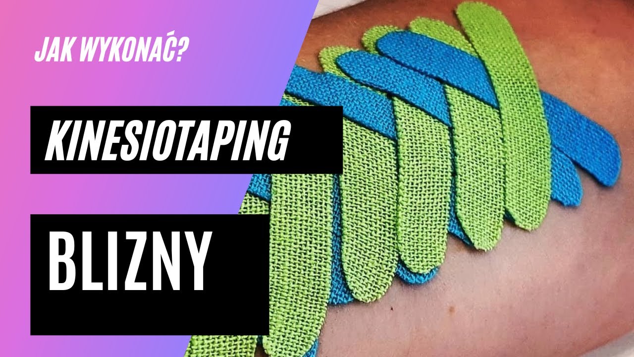 1# Jak tejpować? ‐ kinesiotaping blizny
