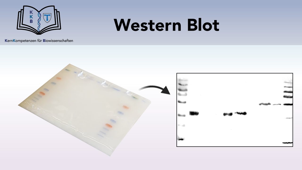 WESTERN BLOT