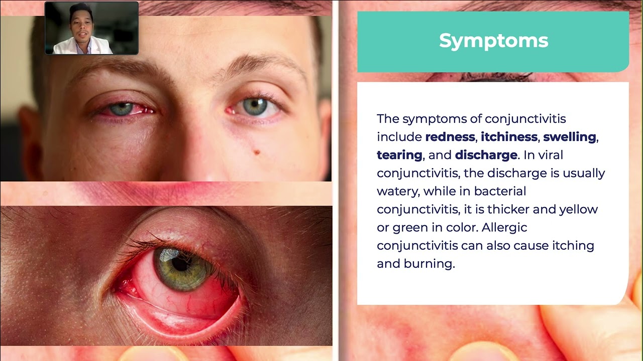 Sore Eyes: Symptoms, Prevention and Treatment.