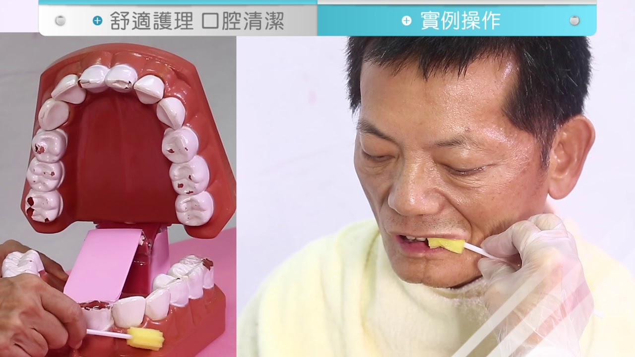 台中榮總-【口腔癌】口腔清潔 真人實作篇