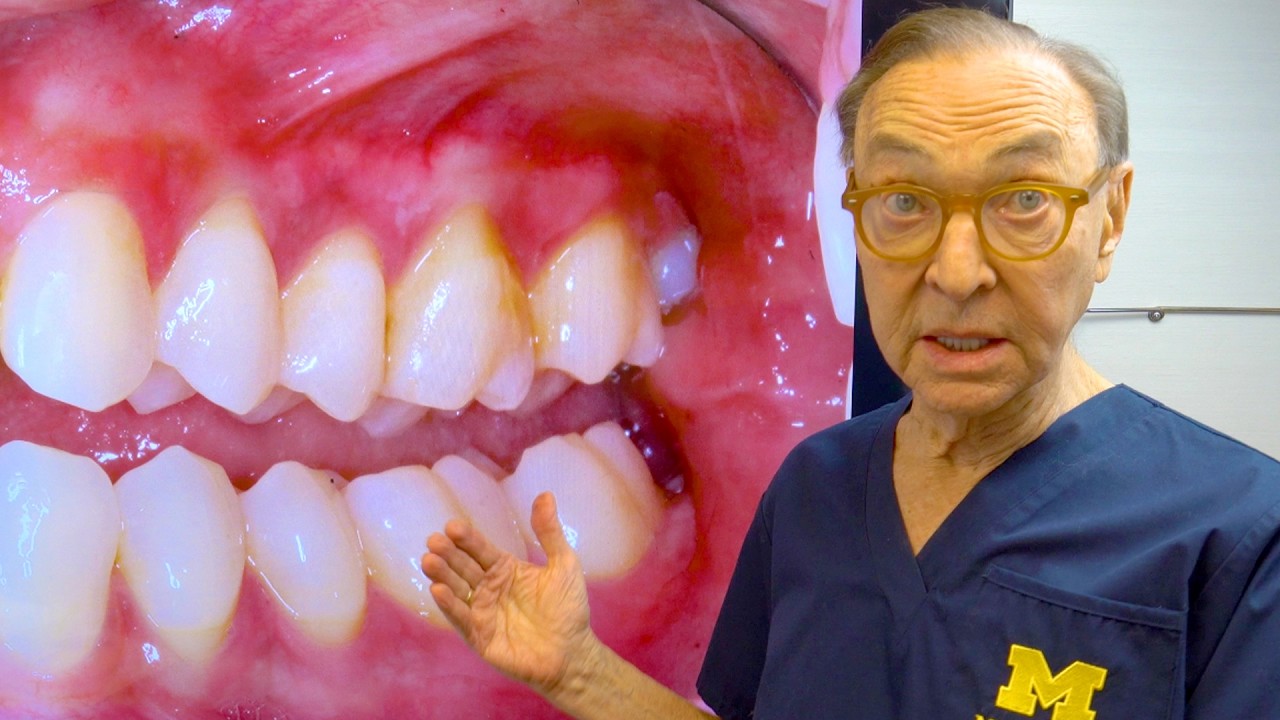 What They DON'T Tell You About Invisalign! 😨