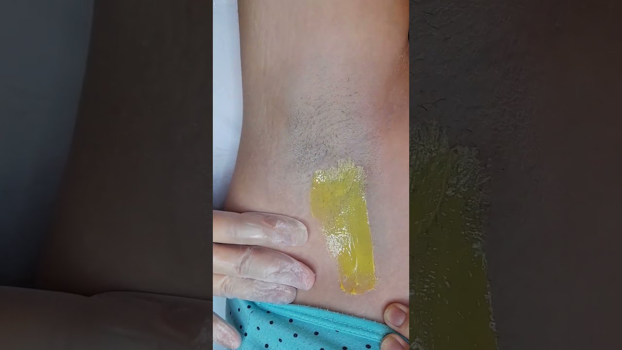 эпиляция подмышек