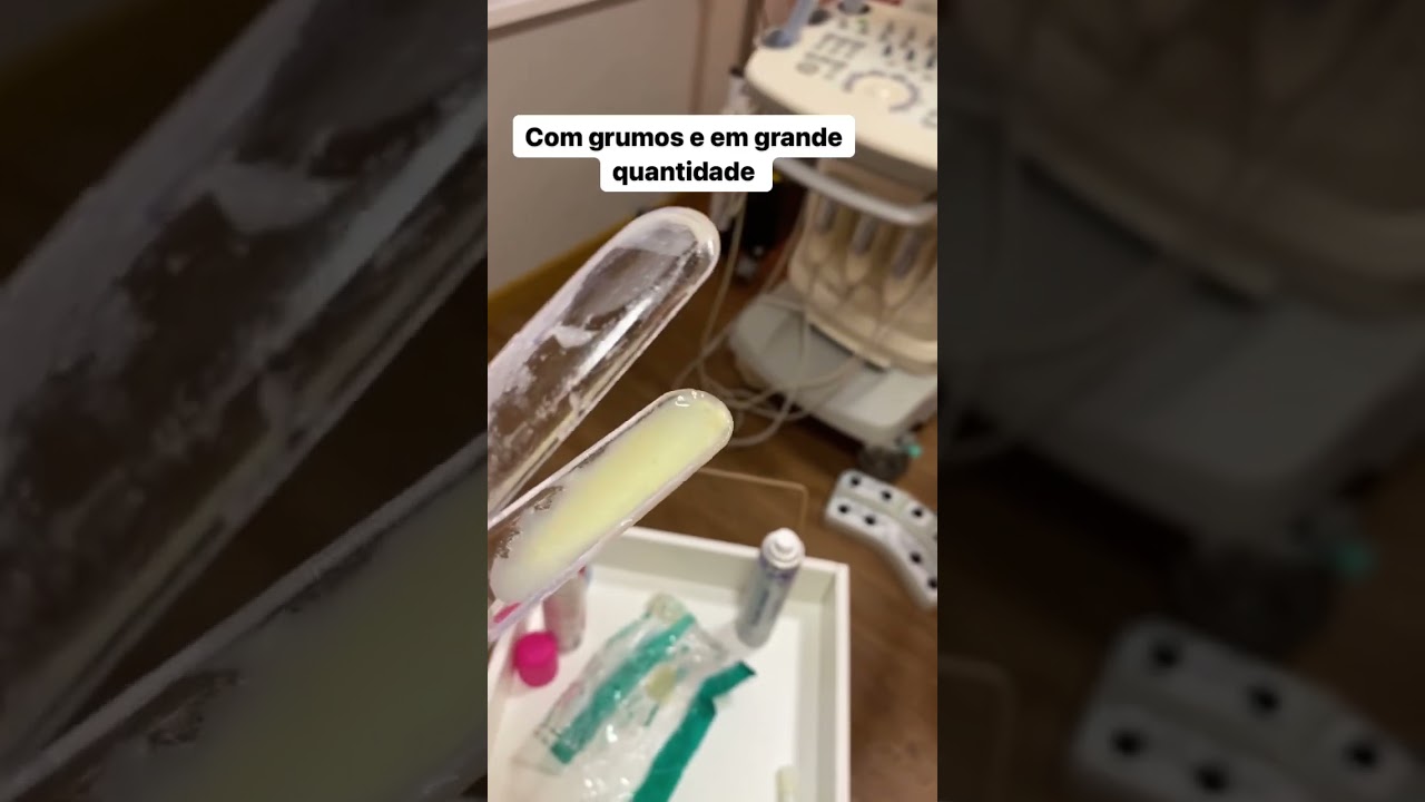 Como é a candidíase? 
