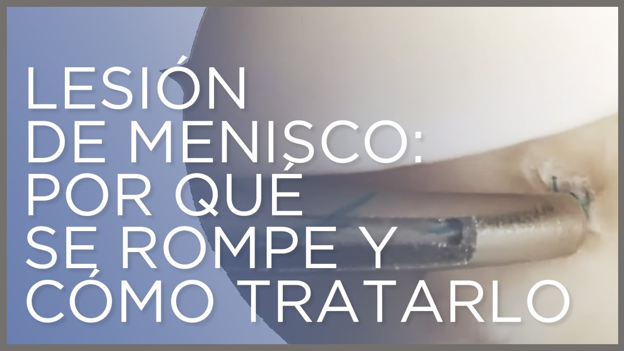 Lesi&oacute;n de menisco: por qu&eacute; se rompe y c&oacute;mo tratarlo