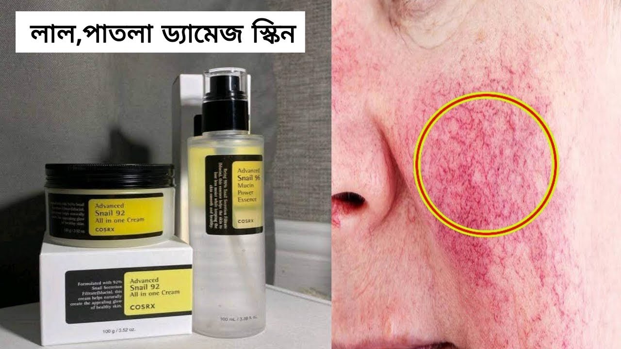  কিভাবে পাতলা স্কিন মোটা করবো?/ Cosrx Snail Mucin Essence and Cream ??স্কিন লাল হয়ে যায়