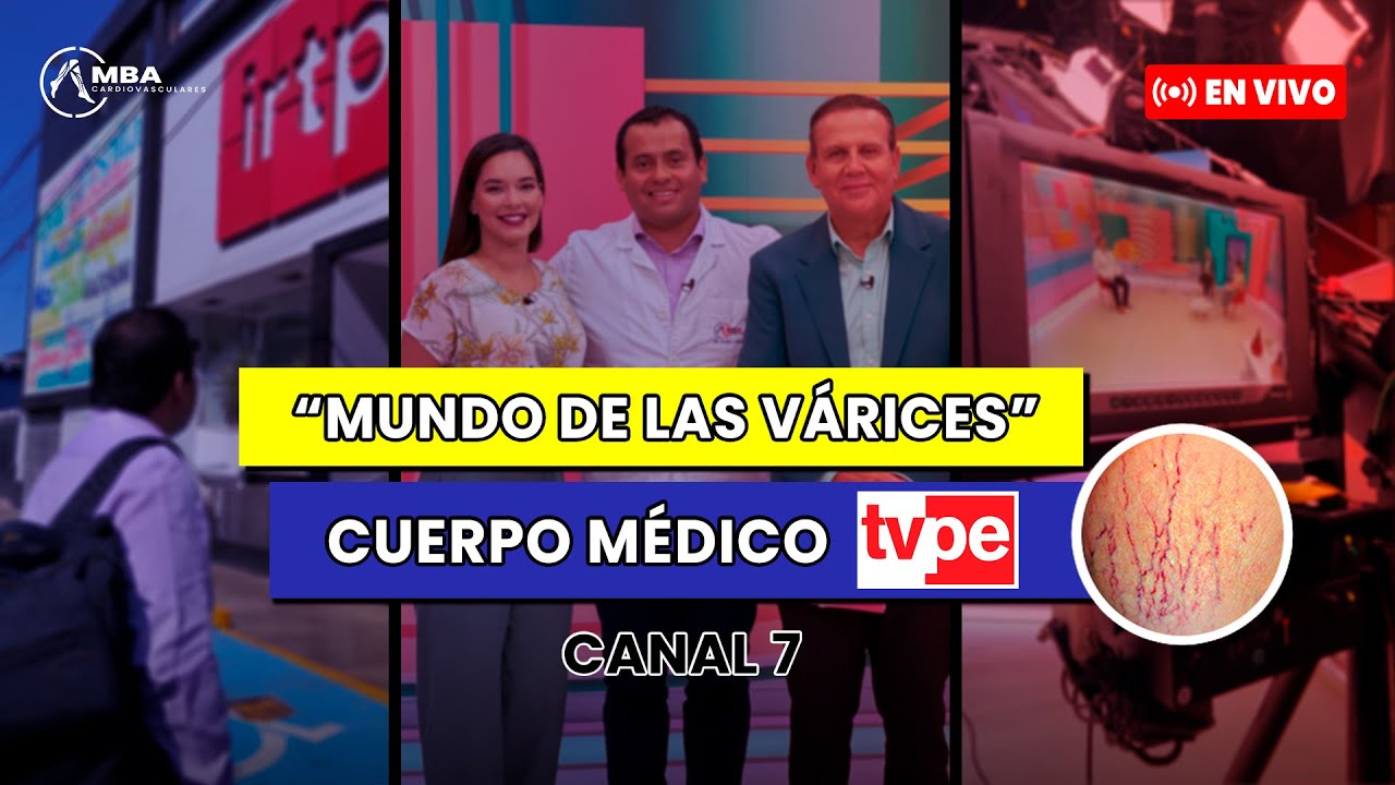 TODO LO QUE TIENES QUE SABER DE LAS VÁRICES 👨‍⚕️😱