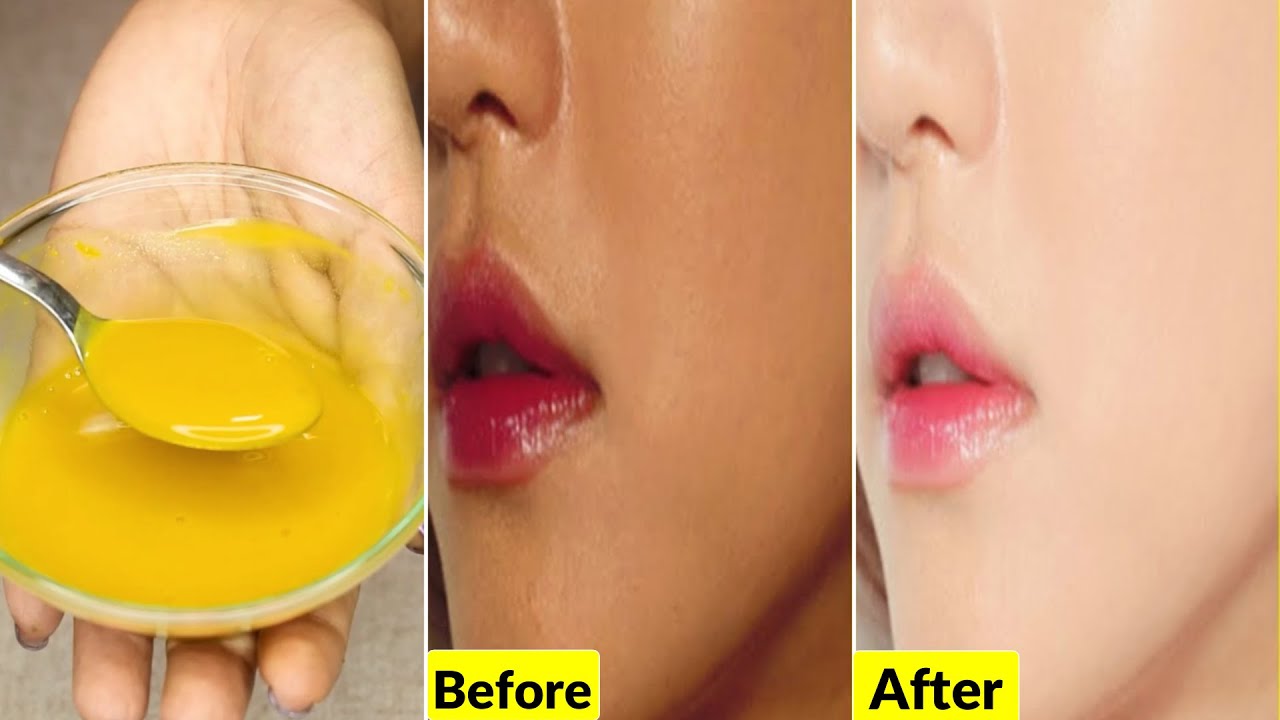 World's Best Celebrity*GLOW SERUM*For Fair Glowing Skin-Clears Pigmentation, Spots, Uneven Dark Skin