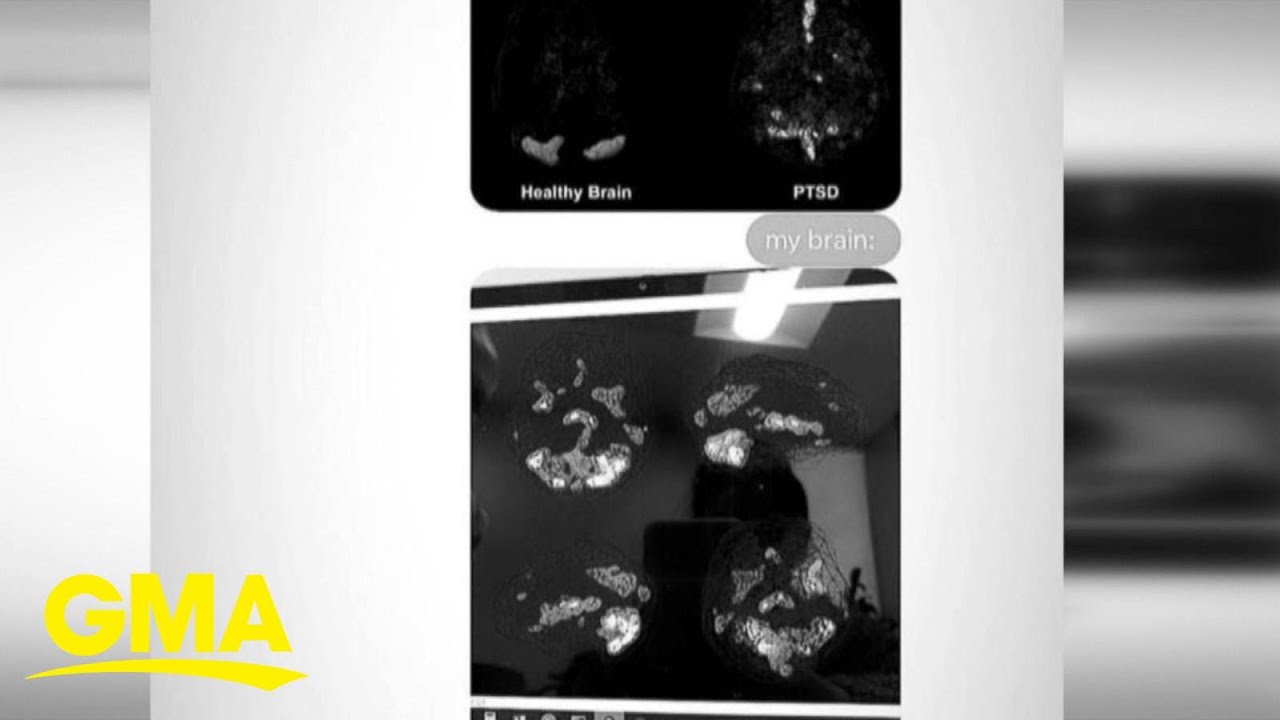 Ariana Grande posting brain scans, sparking conversation about PTSD l GMA