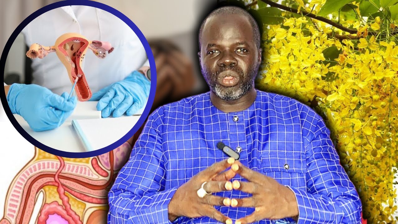 ✍️RÉPONSE : Néww kaatane/ Infections Remède / Séndiégne - Pr Ousmane Ndiaye - SAMA XALAAT TV