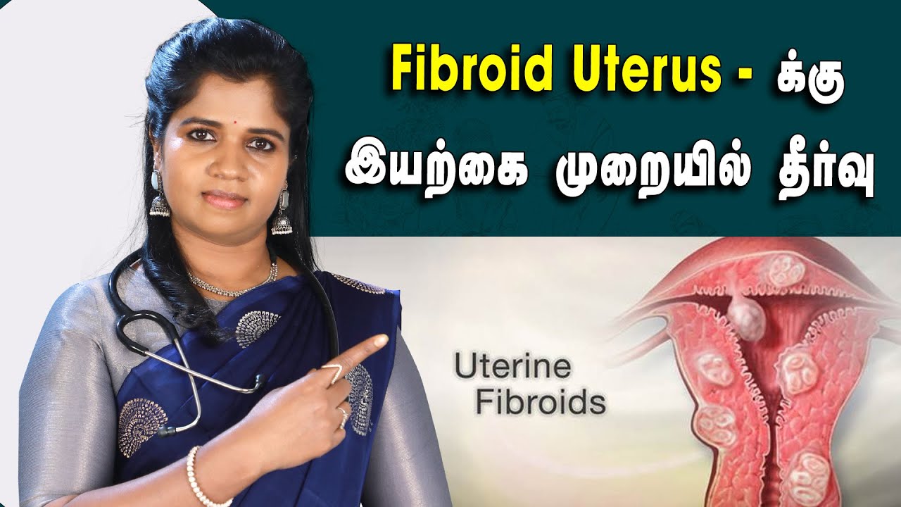 #fibroiduterus | Fibroid Uterus காரணங்கள், அறிகுறிகள் மற்றும் சிகிச்சை முறை | Dr. B.Yoga Vidhya
