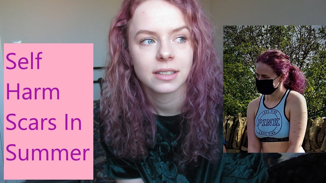 Accepting Our Self Harm Scars // should we have to cover up or hide them?