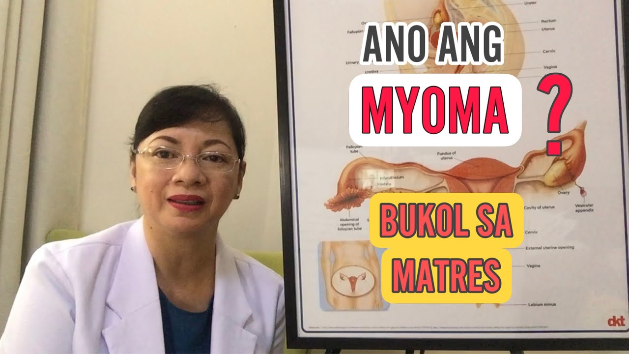 OB-GYNE vlog. Paano ginagamot ang Myoma?   VLOG 2