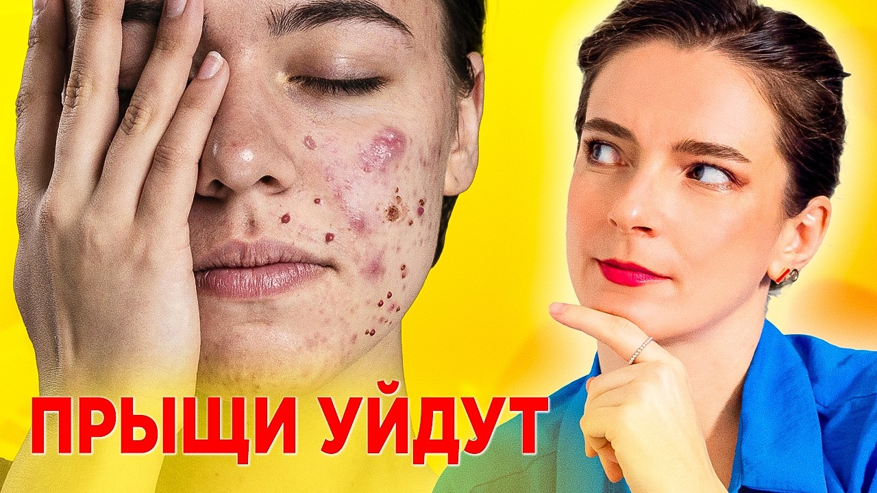 ПРЫЩИ? КОЖА САМА НАЧНЕТ ВОССТАНАВЛИВАТЬСЯ! Узнайте, что нужно для ЗДОРОВОЙ и ЧИСТОЙ КОЖИ!