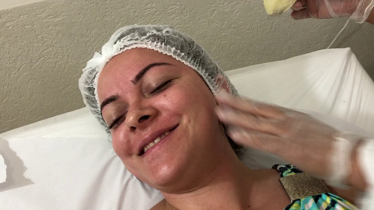 Depilação facial