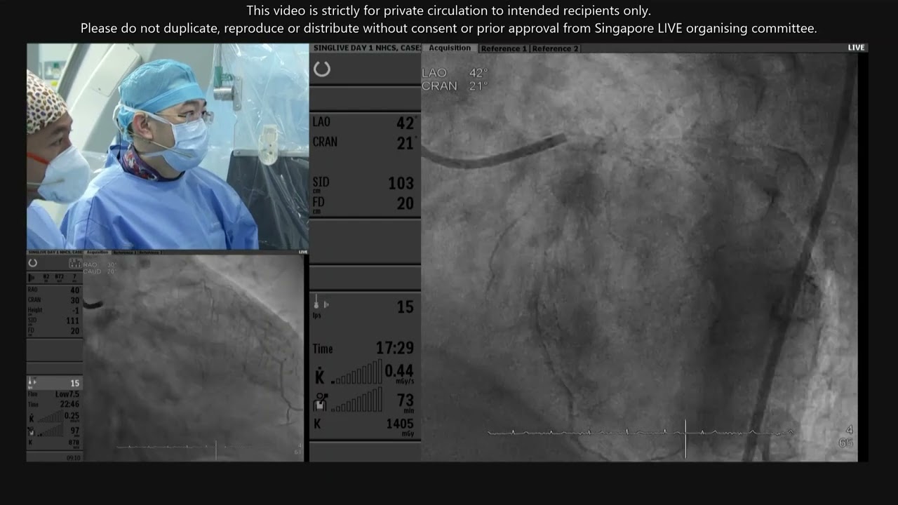 Left Main/ Multivessel Disease - SingLIVE 2023