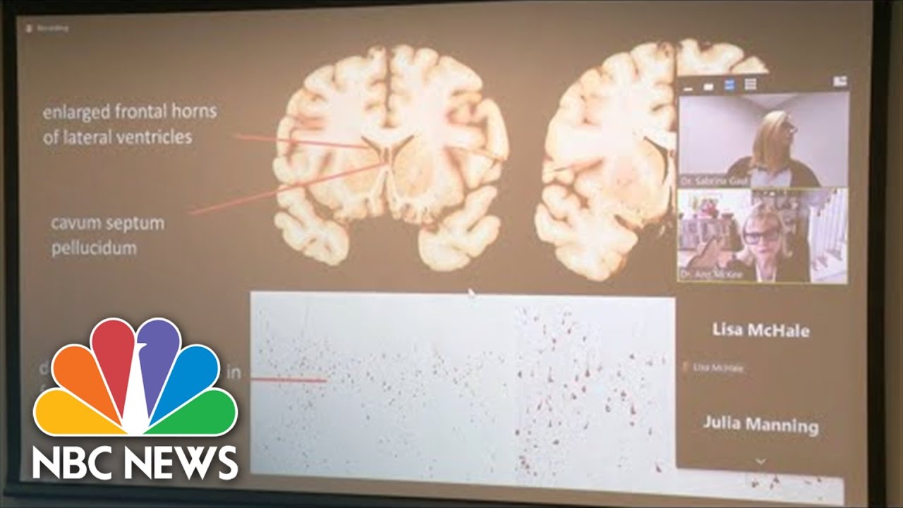 Officials Announce Former NFL Player Phillip Adams Had CTE At Time Of SC Shooting