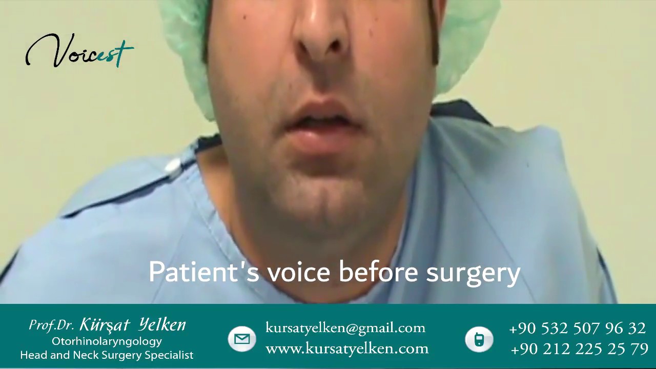Voice Masculinization Surgery, Voice Deepening Surgery