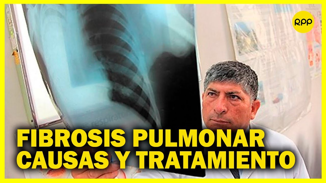 EsSalud: fibrosis destruye los pulmones si no es detectada a tiempo