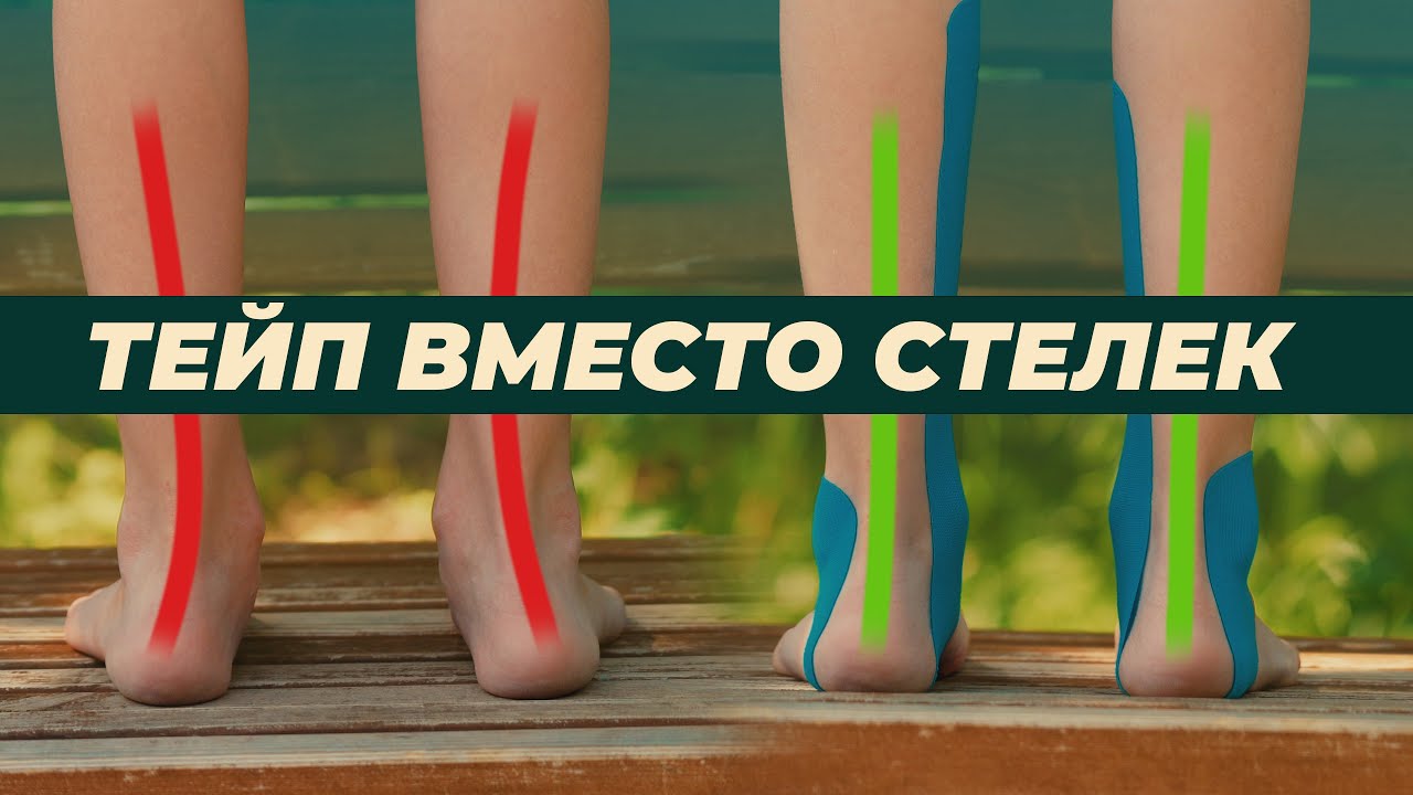 Тейп вместо стелек. Поддержка стопы в открытой обуви для детей и взрослых