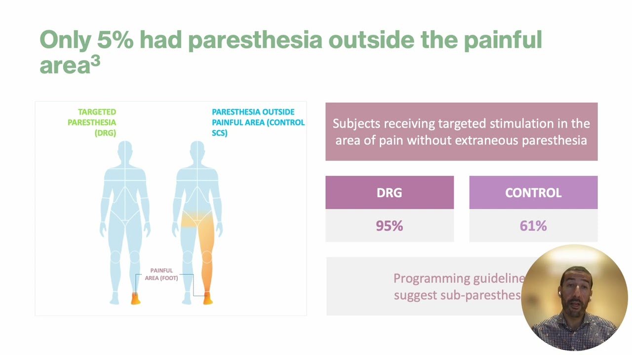 DRG stimulation   Patient selection and clinical evidence by Pedram Tabatabaie