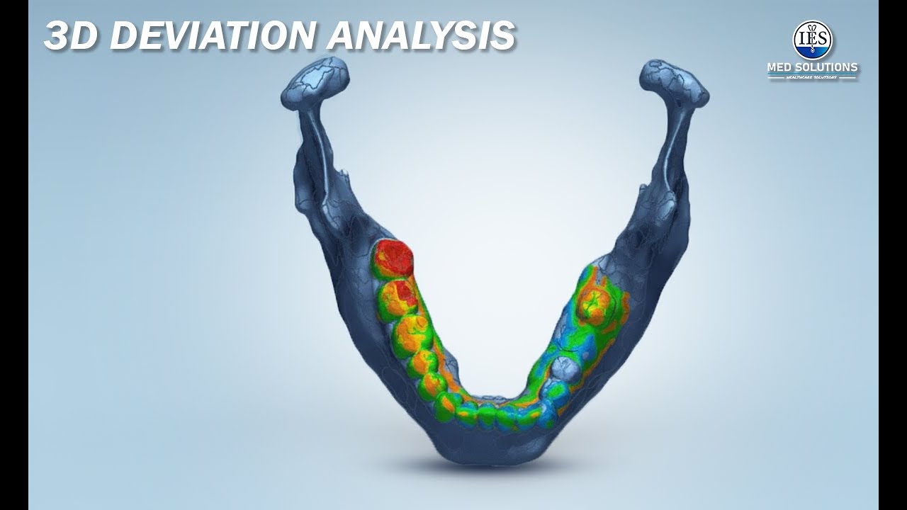 “3D Deviation Analysis Explained | Digital Accuracy in Dentistry”