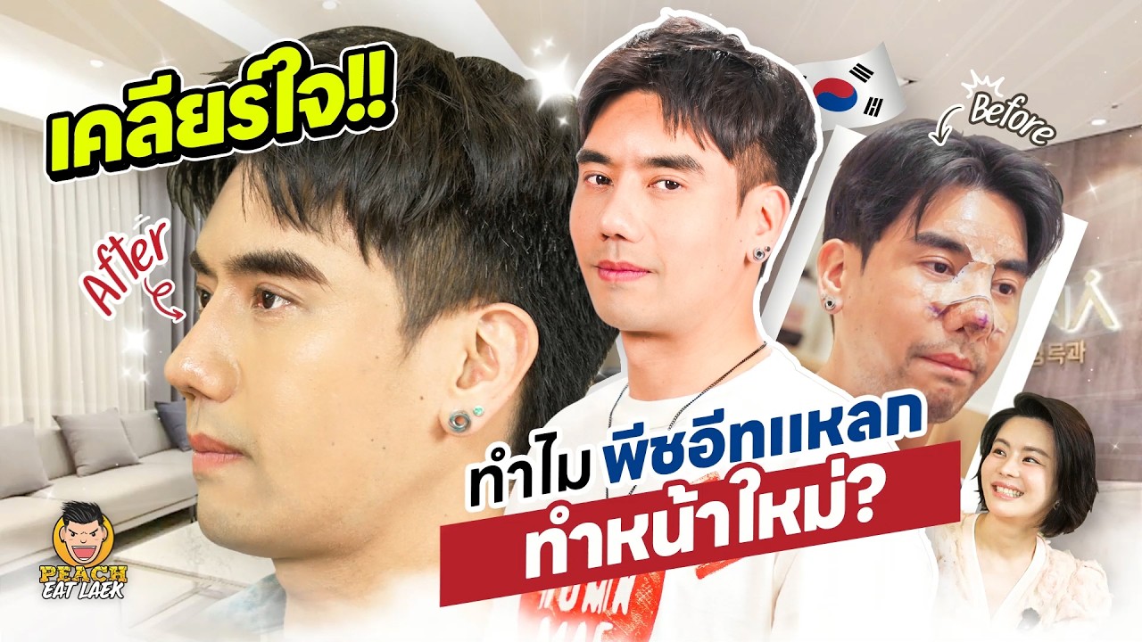 Update 2 เดือนกับความหล่อของ Peach Eat Laek