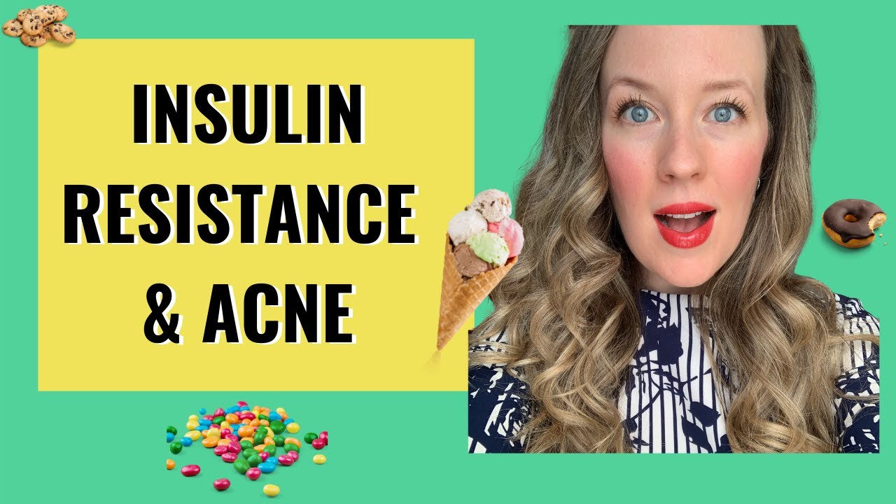 Insulin Resistance and Acne - SWEET TOOTH MAKING YOU BREAKOUT?