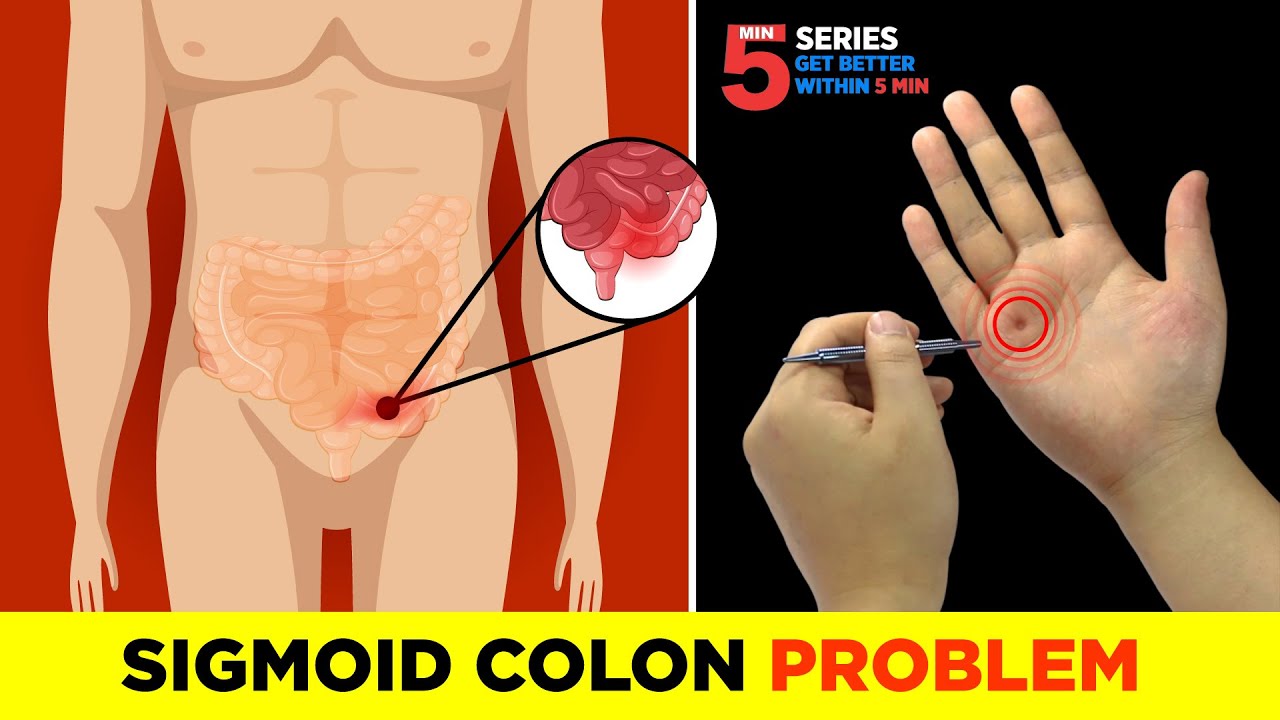 Sujok Treatment For Sigmoid Colon's Problems😖🔥