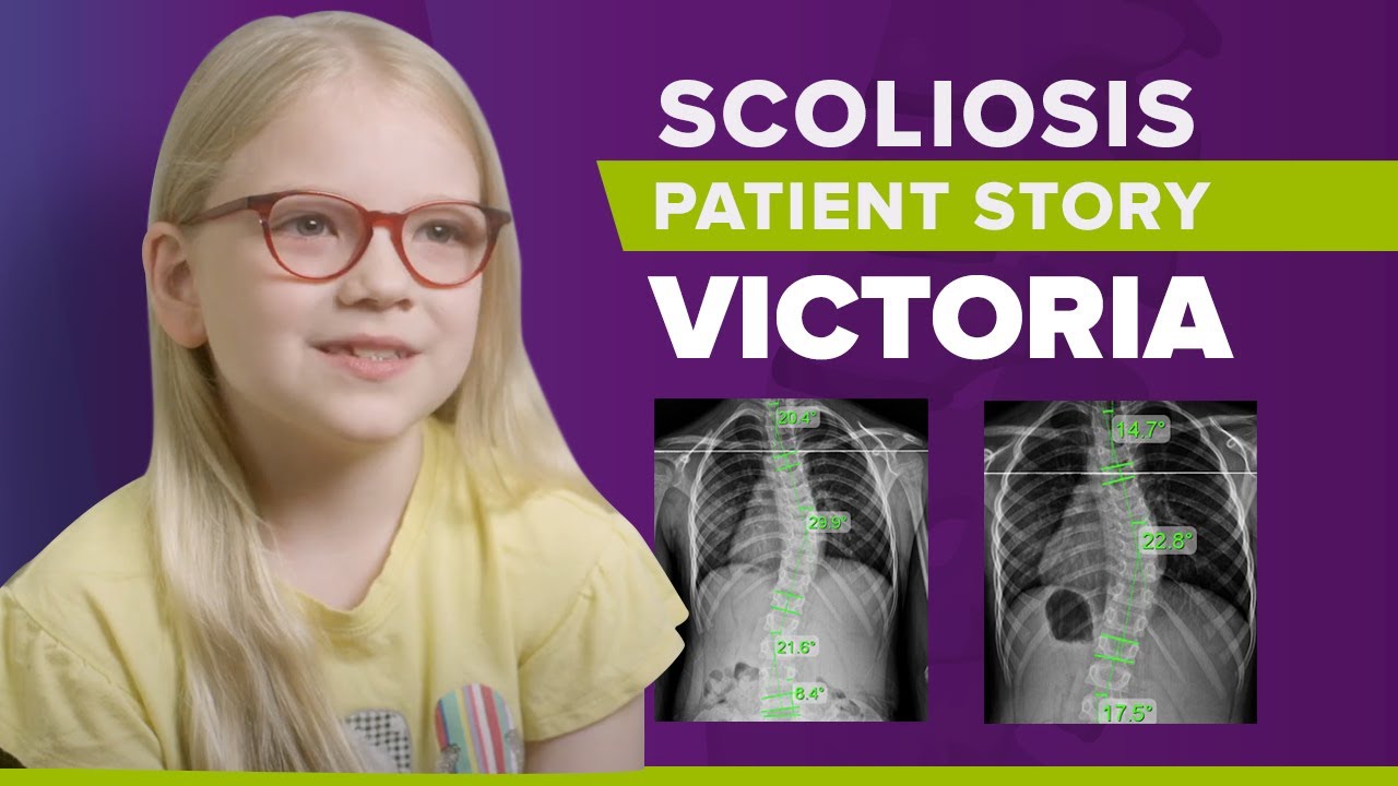 Scoliosis Surgery vs Scoliosis Treatment Without Surgery: Victoria's Story