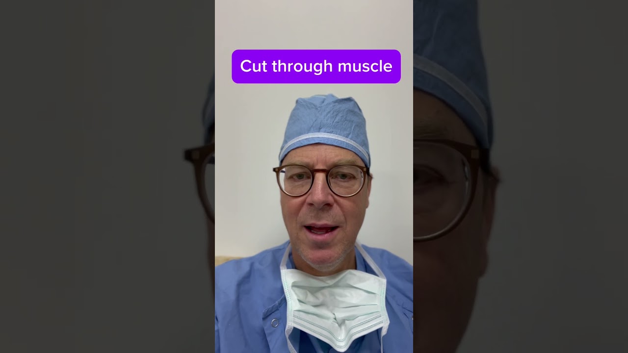 Learn the steps that a Brain surgeon uses to expose the human brain #doctor #interestingfacts #short