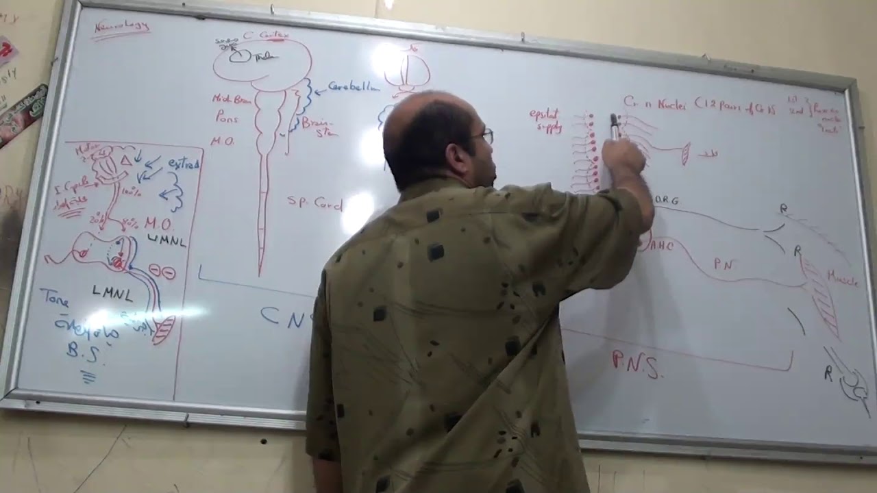 2-HEMIPLEGIA 1 دكتور يوسف