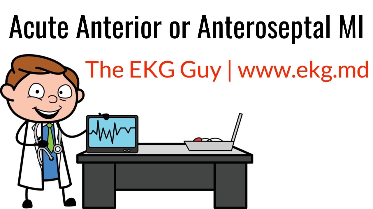 Acute Anterior or Anteroseptal MI on EKG / ECG l The EKG Guy - www.ekg.md