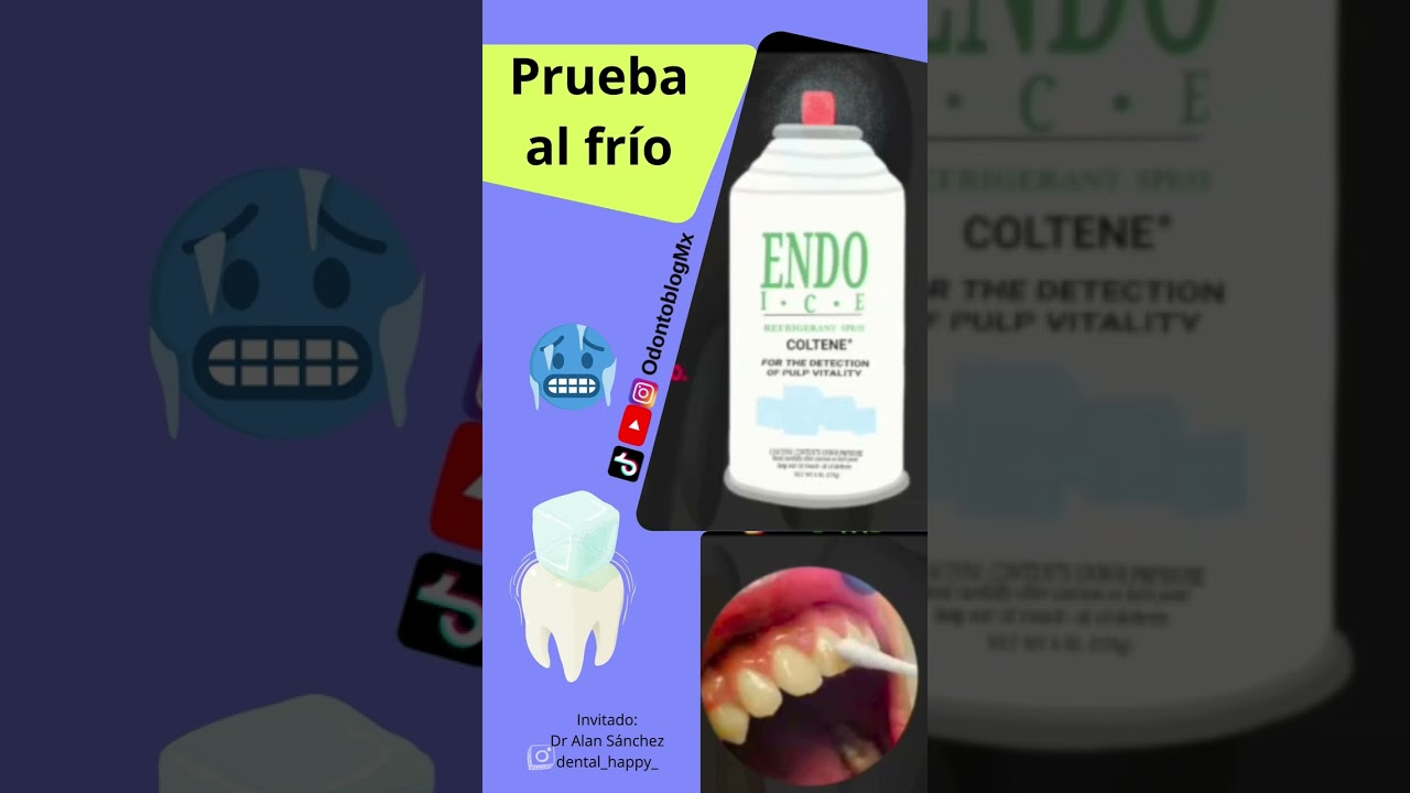 Prueba de vitalidad pulpar al frío🥶 🧊 🦷 Endo Ice