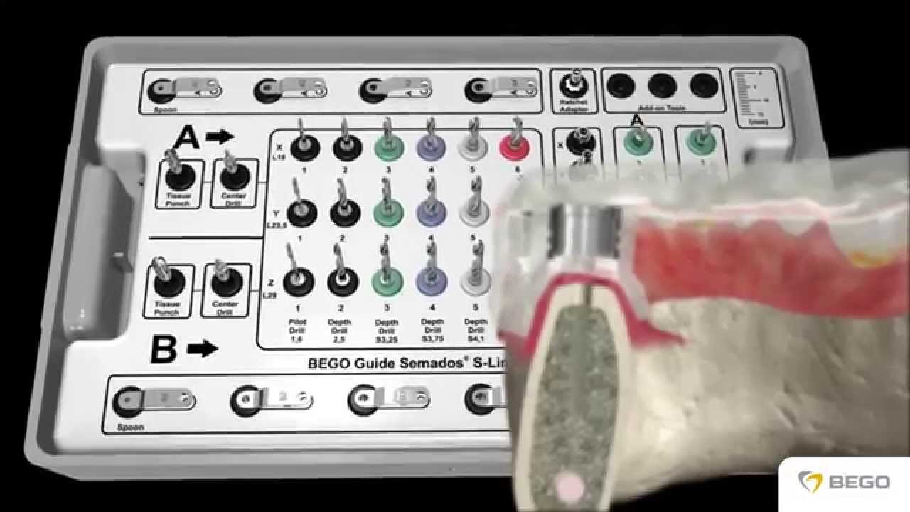 The Bego Guide S-Line Tray